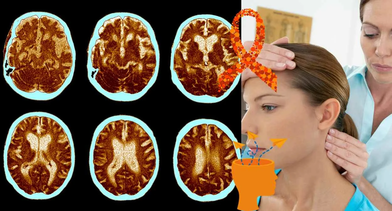 Understanding Neurological Disorders
